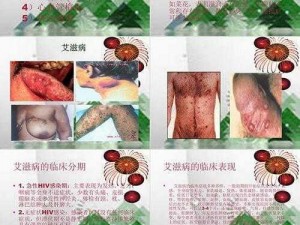 男生发育迟缓该怎么办？看这里真人对照 PPT 解答