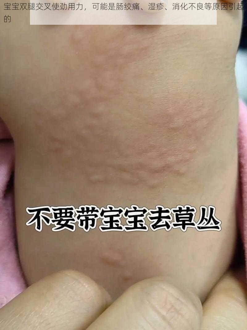 宝宝双腿交叉使劲用力，可能是肠绞痛、湿疹、消化不良等原因引起的