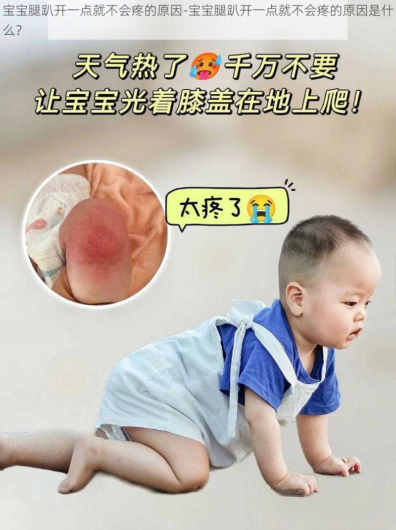 宝宝腿趴开一点就不会疼的原因-宝宝腿趴开一点就不会疼的原因是什么？