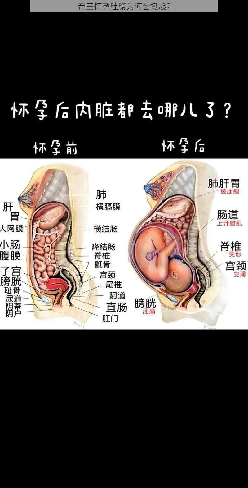 帝王怀孕肚腹为何会挺起？