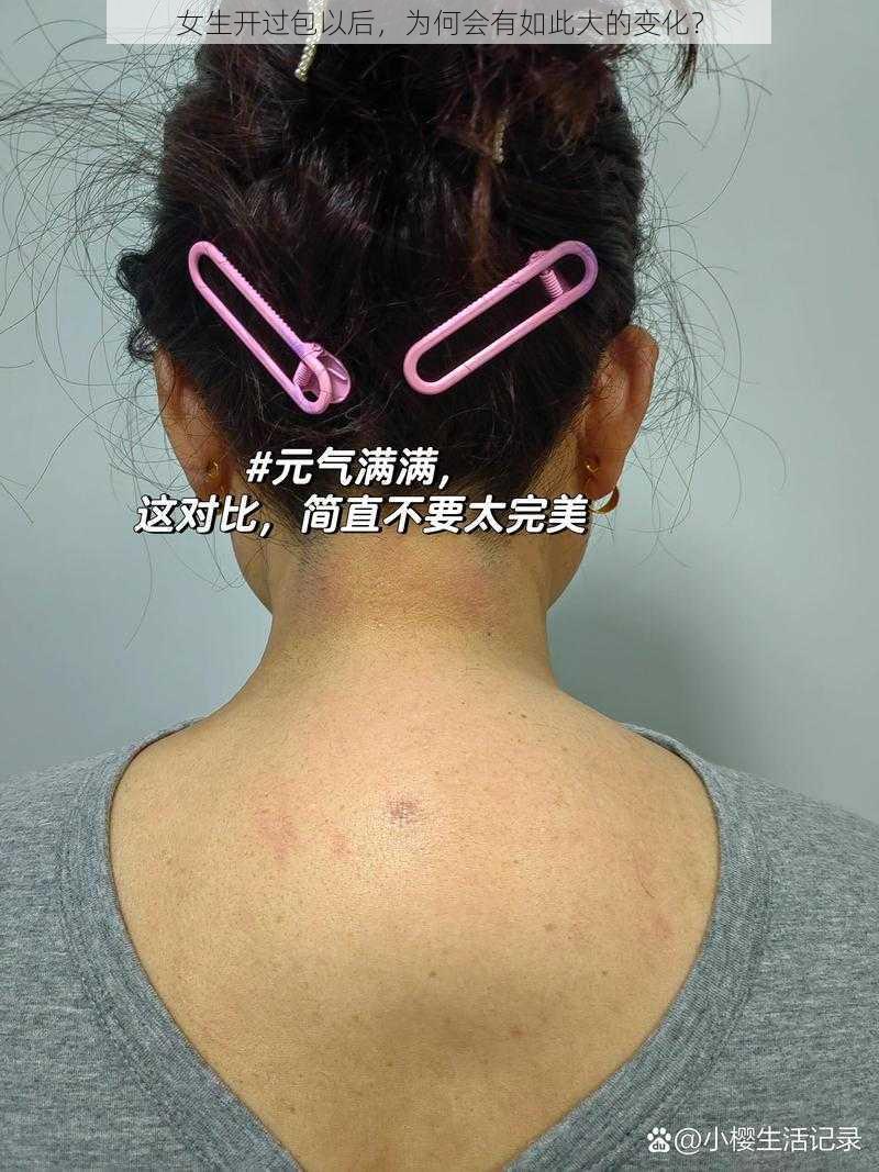 女生开过包以后，为何会有如此大的变化？